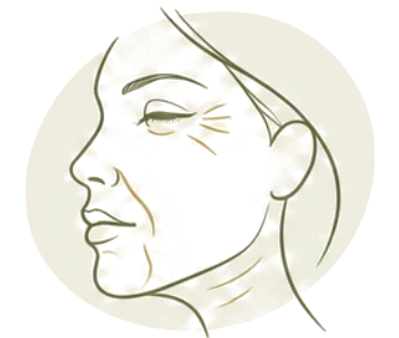Illustratie huidveroudering: lijntekening van een vrouwengezicht met fijne lijntjes rond oog, mond en hals