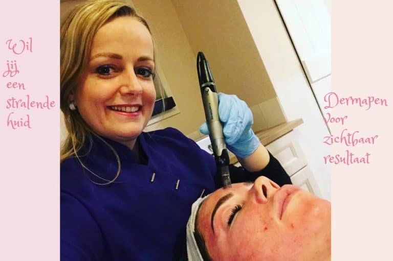Dermapen behandeling